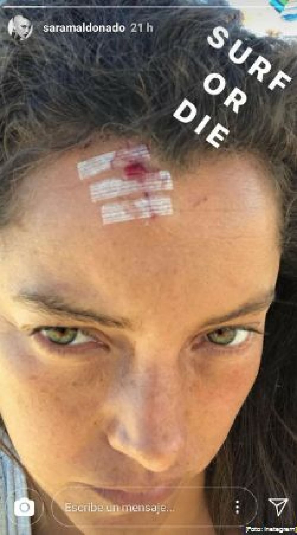 EN PLENAS VACACIONES, SARA MALDONADO SUFRE ACCIDENTE ...